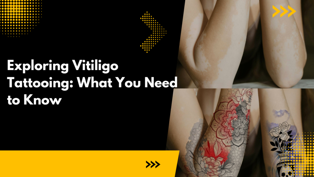 Exploring Vitiligo Tattooing: What You Need to Know